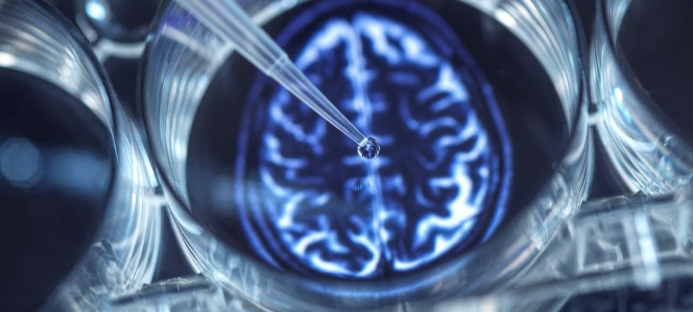 terapia con psicodélicos
