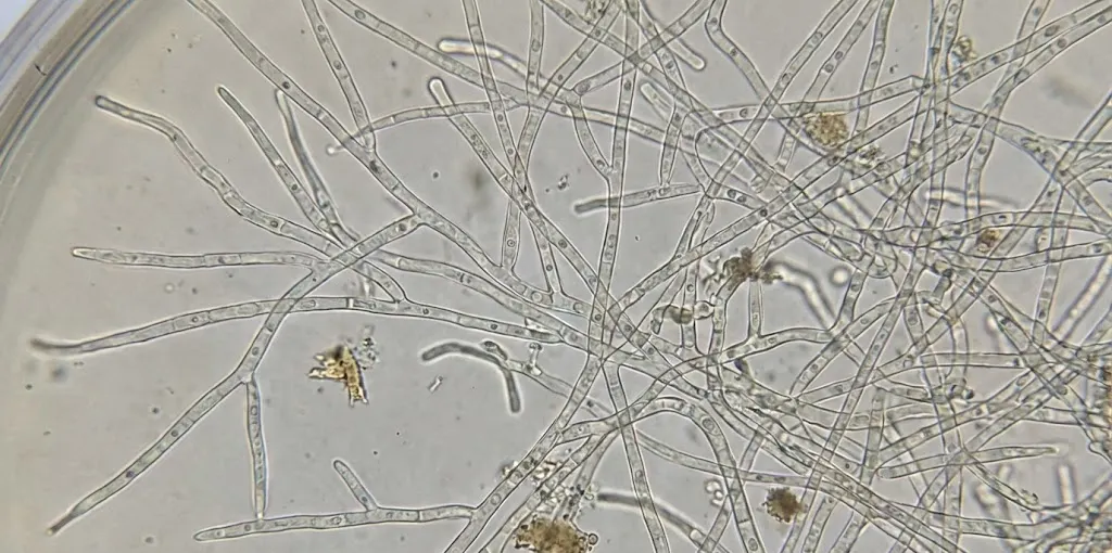 Hifas de hongos observadas al microscopio formando la red microscópica del micelio fúngico